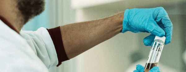 New Report Reveals Only 7% of CBD Companies Properly Test Products
