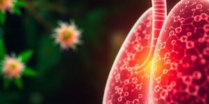 Healthy lung cells in a green, calm setting with no oxidative stress or inflammation